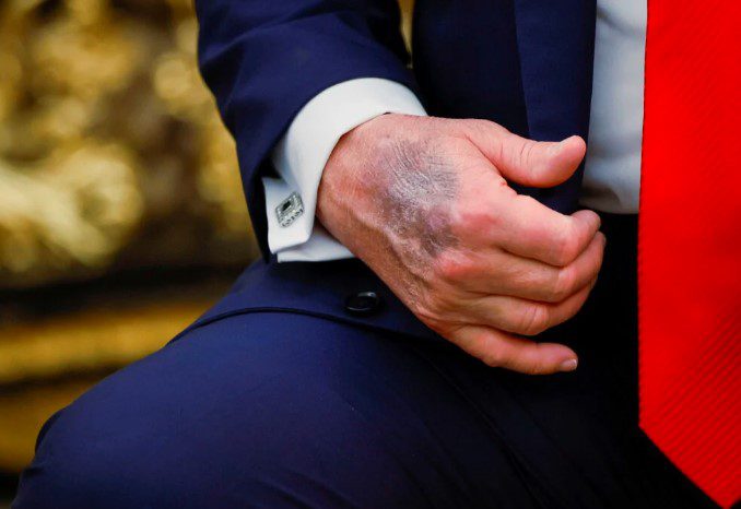Platforma X preplavljena lažnim glasinama: Korisnici šire priču da je Donald Trump mrtav