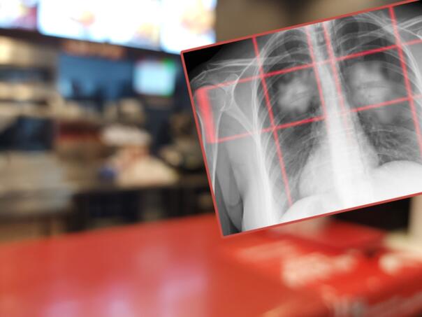 va hrana povećava rizik od raka pluća za čak 41%